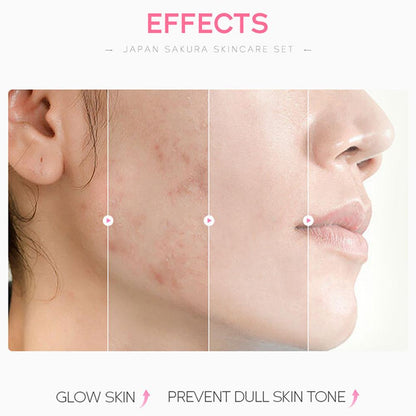 Sakura Facial Skincare Set for Women – Cleanser, Toner, Serum, Eye & Face Cream