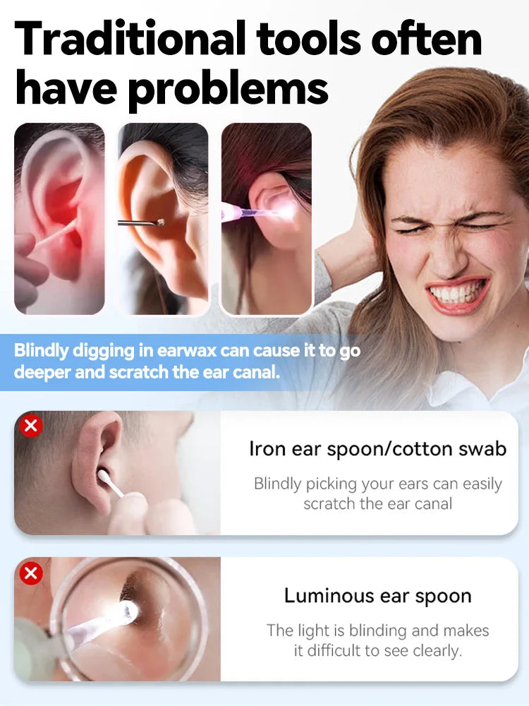 Visual Ear Wax Cleaner Camera – Smart Ear Cleaning Endoscope Tool