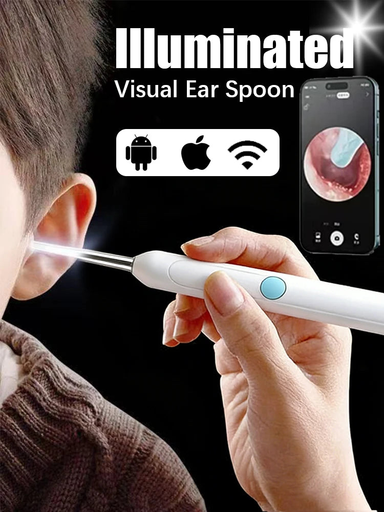 Visual Ear Wax Cleaner Camera – Smart Ear Cleaning Endoscope Tool