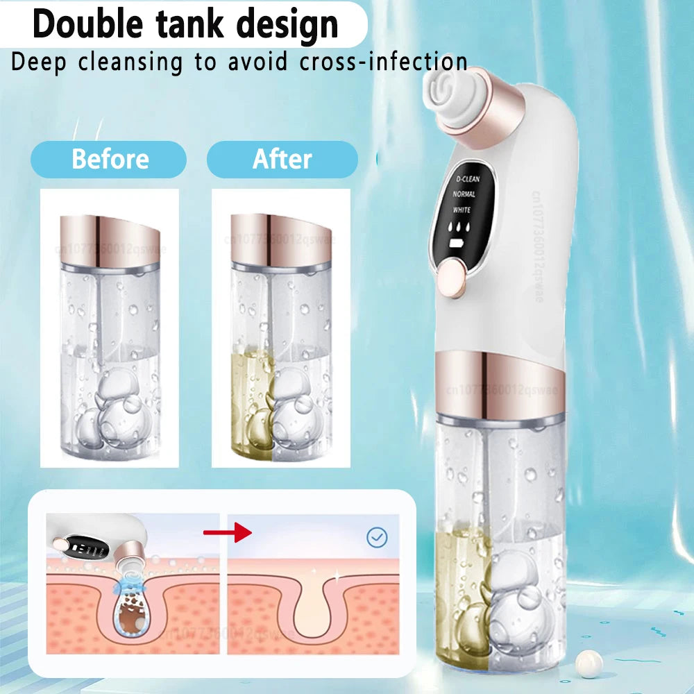 Blackhead Remover Pore Vacuum – Electric USB Face Cleaner for Acne & Black Dot Removal