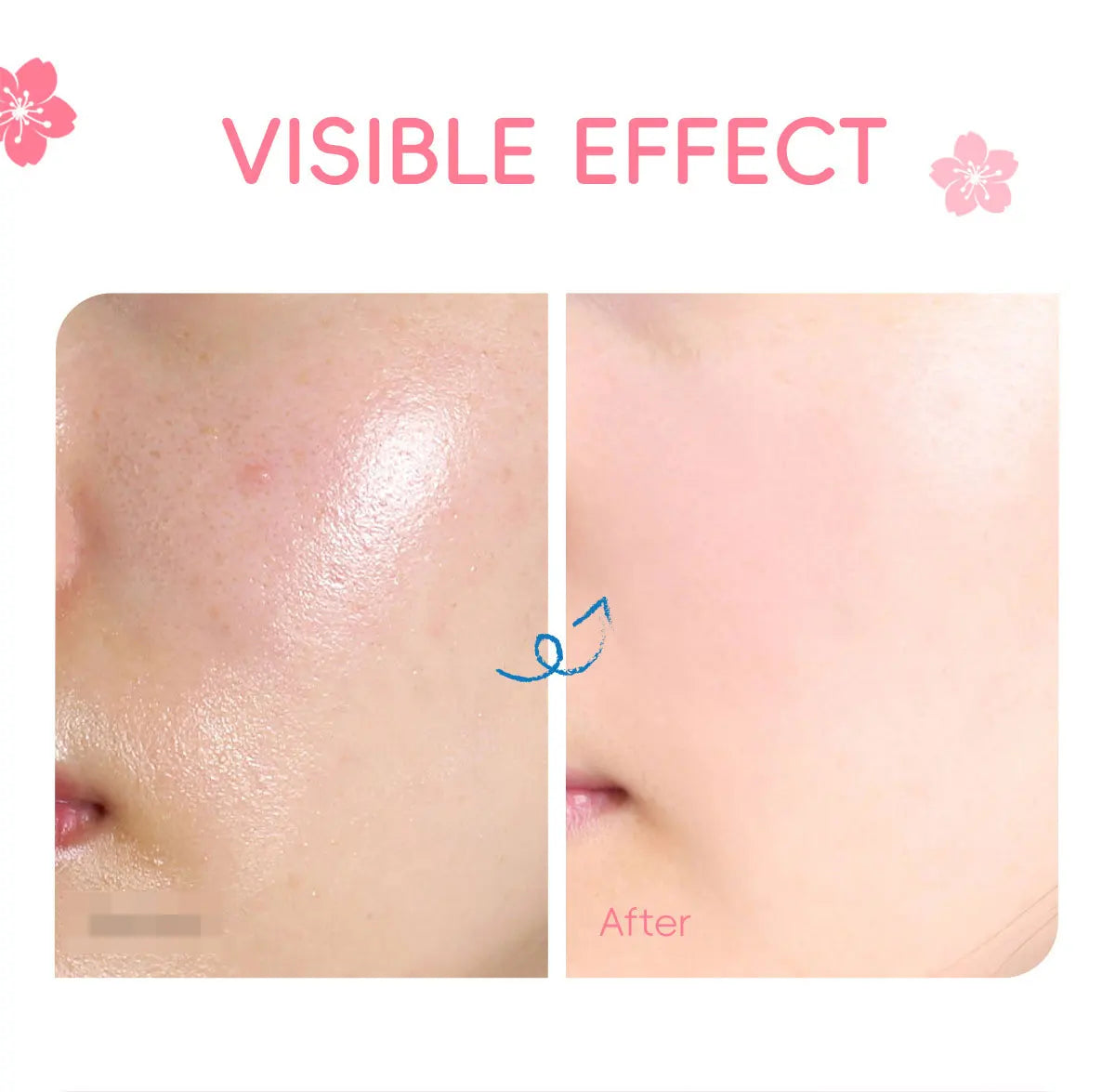 Sakura Whitening Face Cream – Anti-Aging Wrinkle Remover & Firming Moisturiser for Radiant Skin