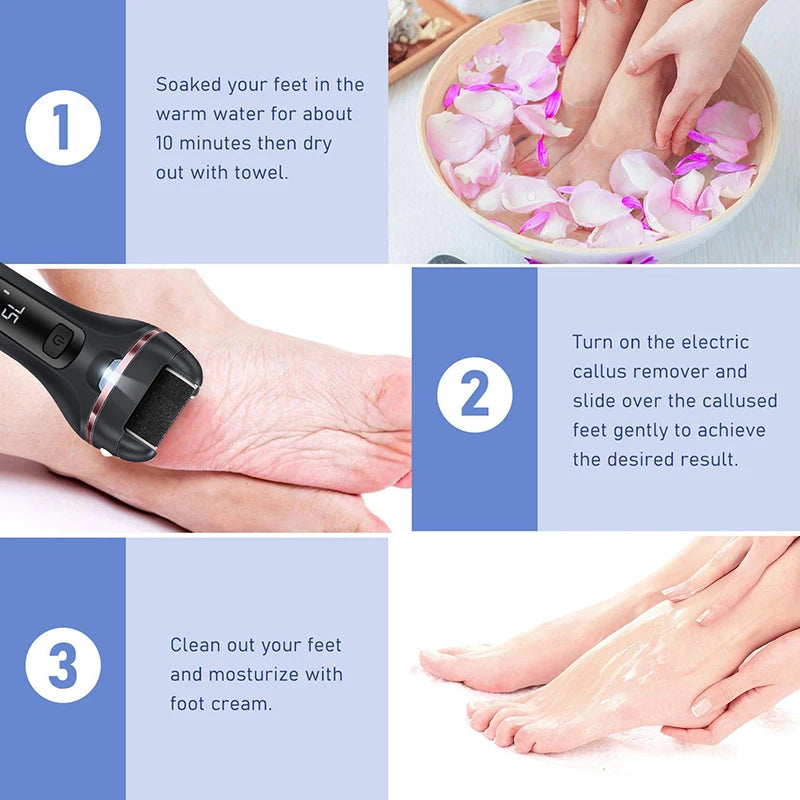 Electric Foot Callus Remover – Pedicure Grinder & Foot Care Tool