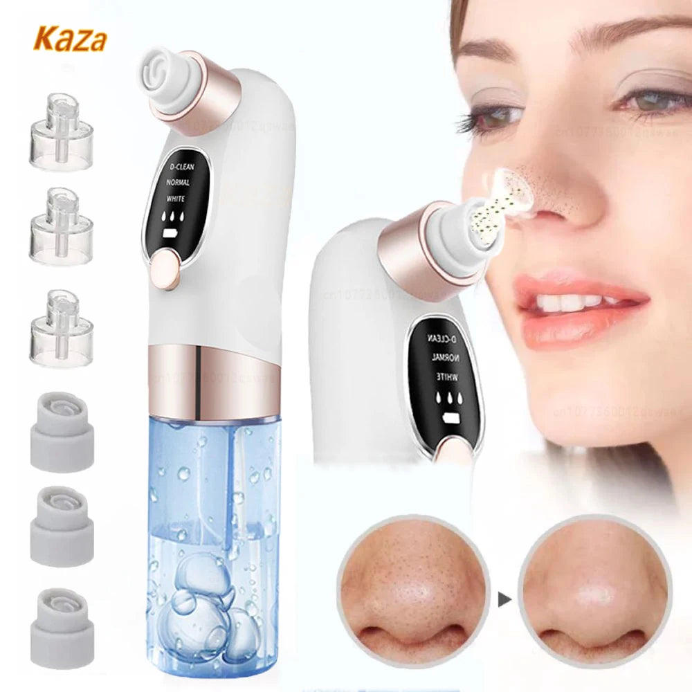 Blackhead Remover Pore Vacuum – Electric USB Face Cleaner for Acne & Black Dot Removal