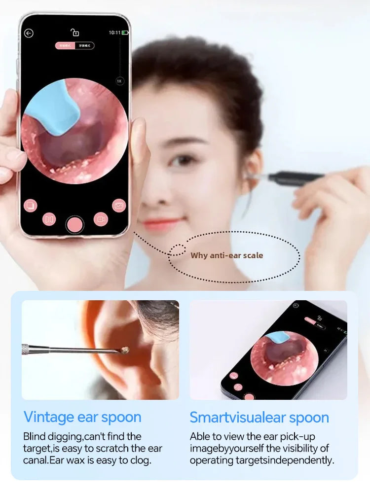 Visual Ear Wax Cleaner Camera – Smart Ear Cleaning Endoscope Tool