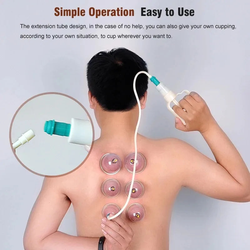 32PCS Vacuum Cupping Set – Body Massage & Anti Cellulite Therapy