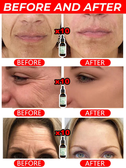 Anti-Wrinkle Face Serum Combo