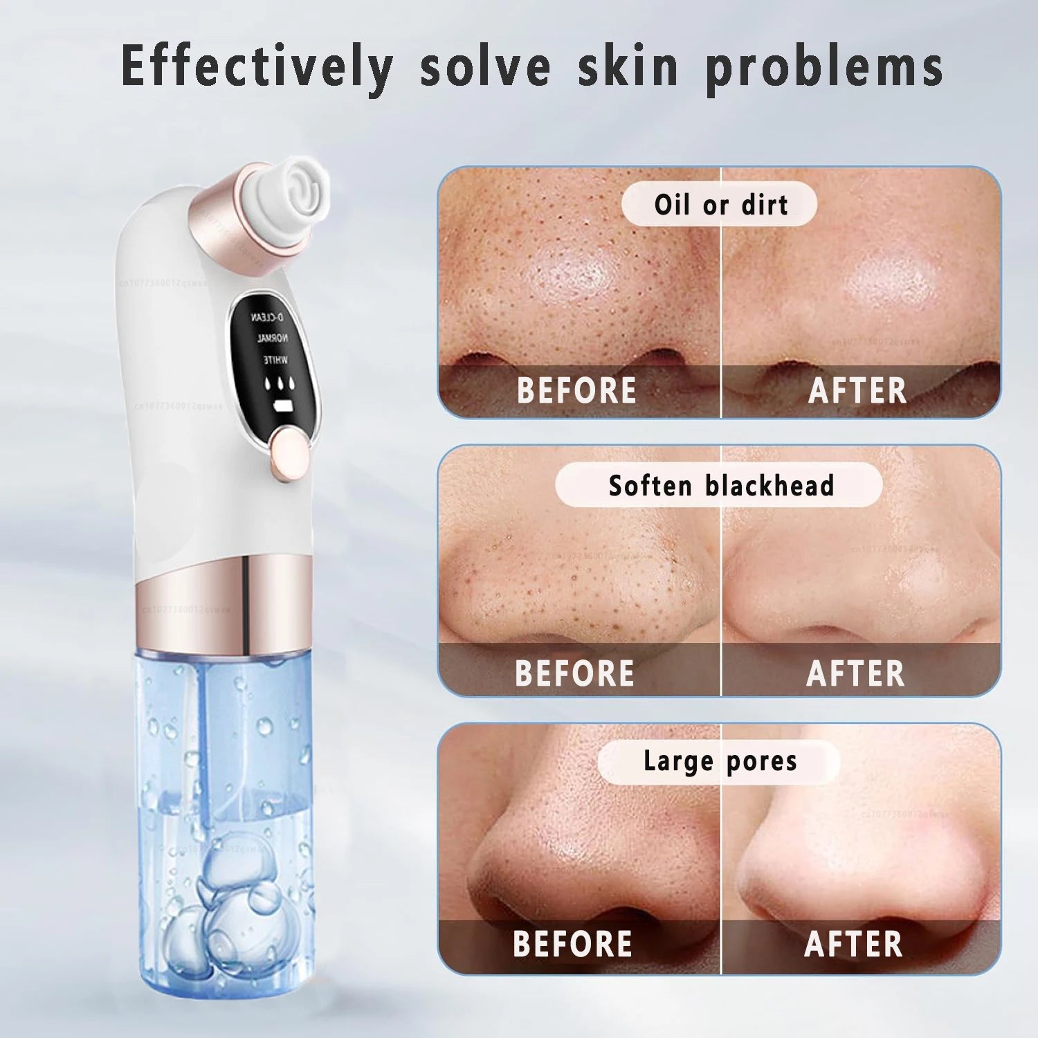 Blackhead Remover Pore Vacuum – Electric USB Face Cleaner for Acne & Black Dot Removal