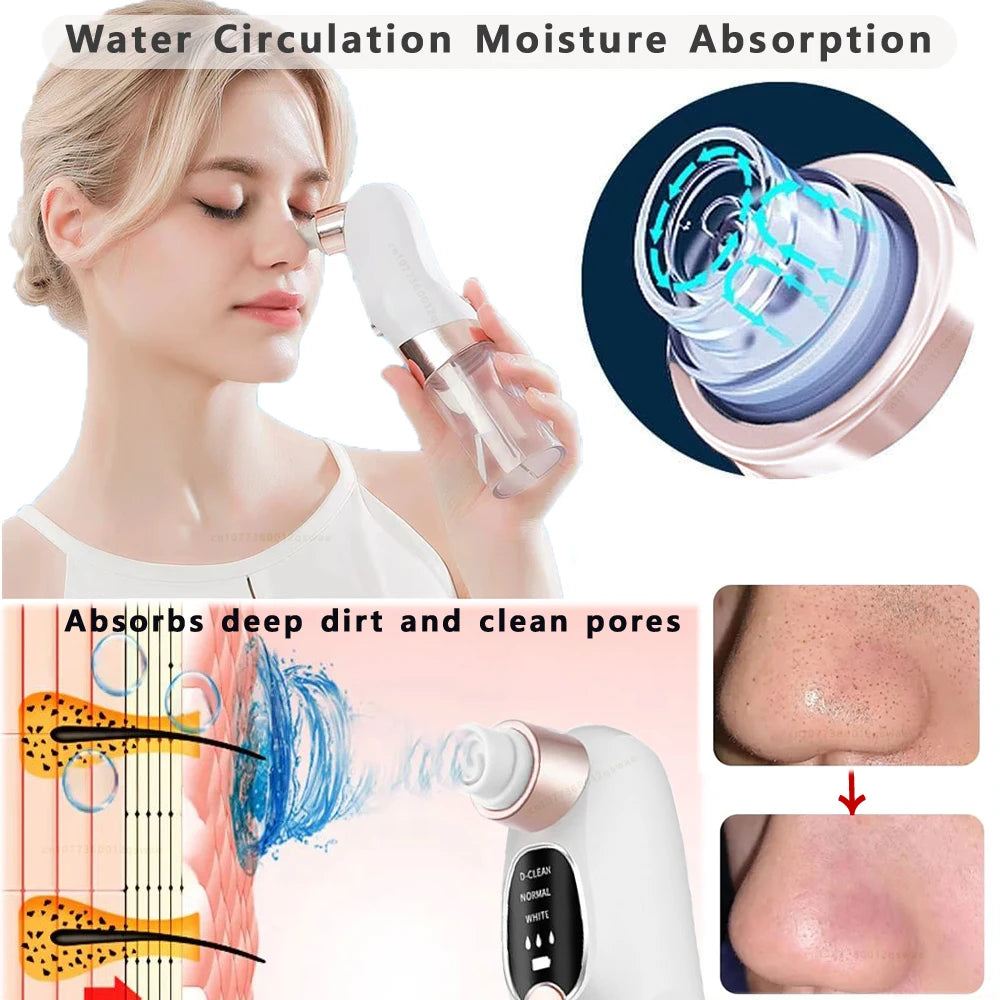 Blackhead Remover Pore Vacuum – Electric USB Face Cleaner for Acne & Black Dot Removal